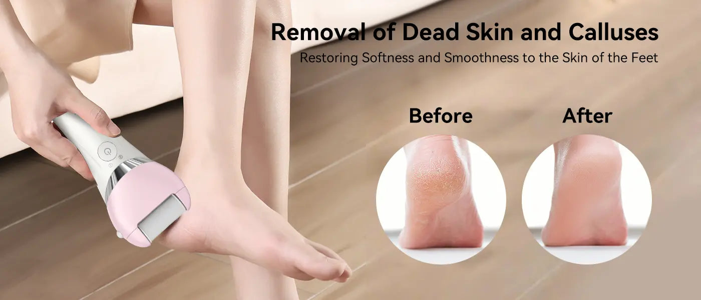 PRITECH Hair Callus & Hair Remover | BCM-1141