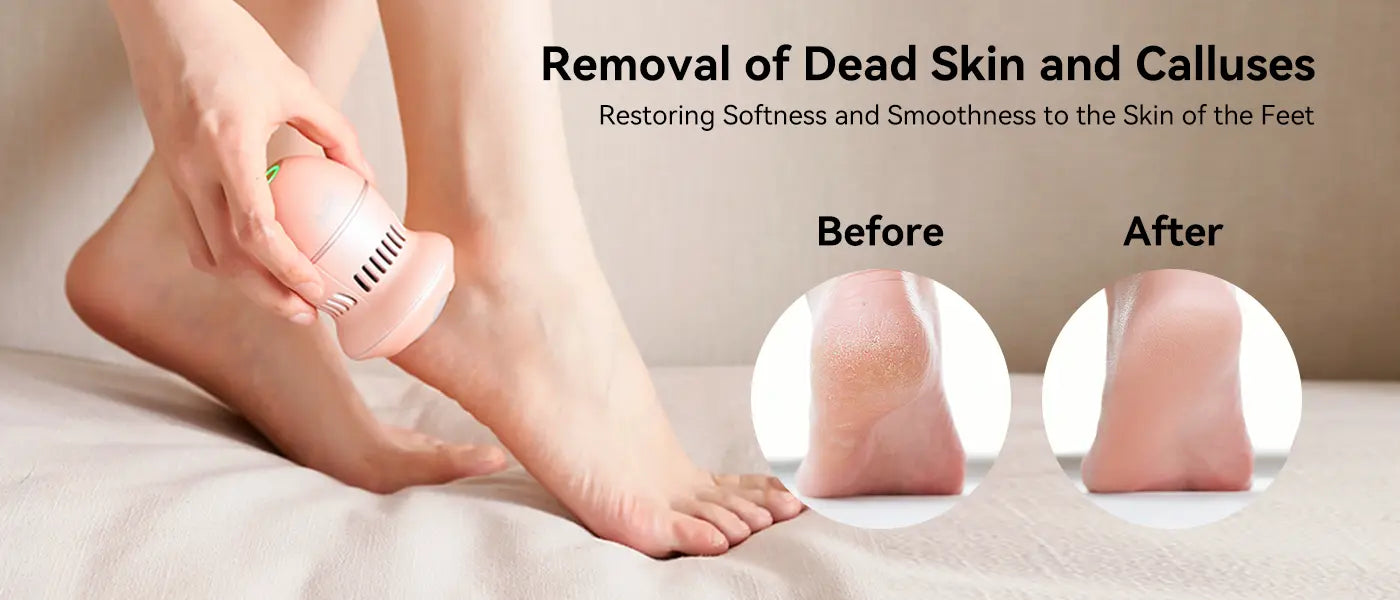 PRITECH Callus Remover | BCM-1253