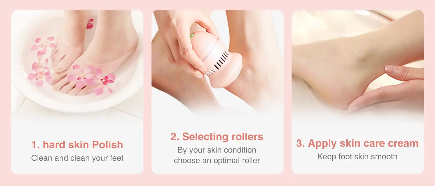 PRITECH Callus Remover | BCM-1253