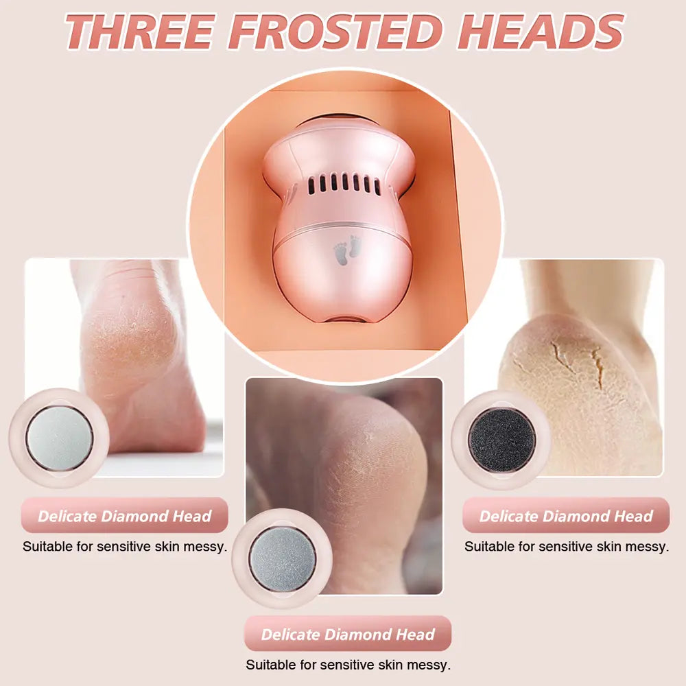 PRITECH Callus Remover | BCM-1253