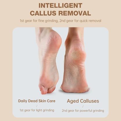 PRITECH Callus Remover – Electric Foot File | BCM-1138