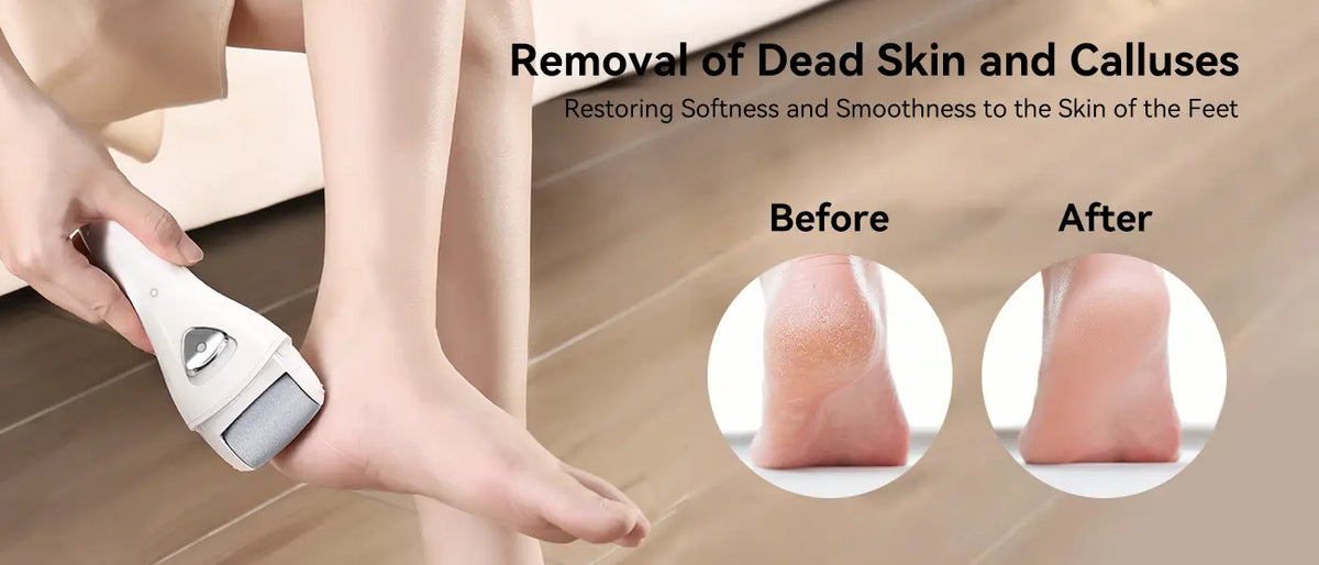 PRITECH Callus Remover – Electric Foot File | BCM-1138 Detail Image