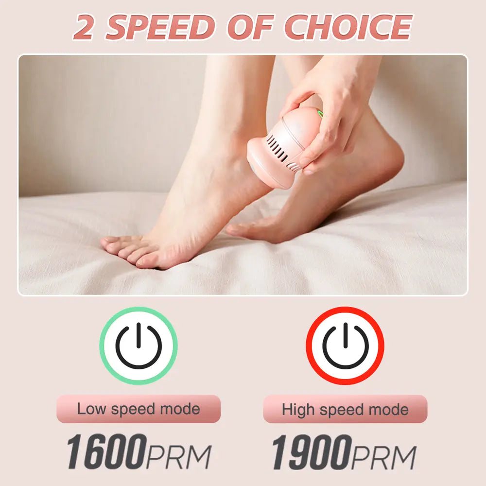 PRITECH Callus Remover | BCM-1253