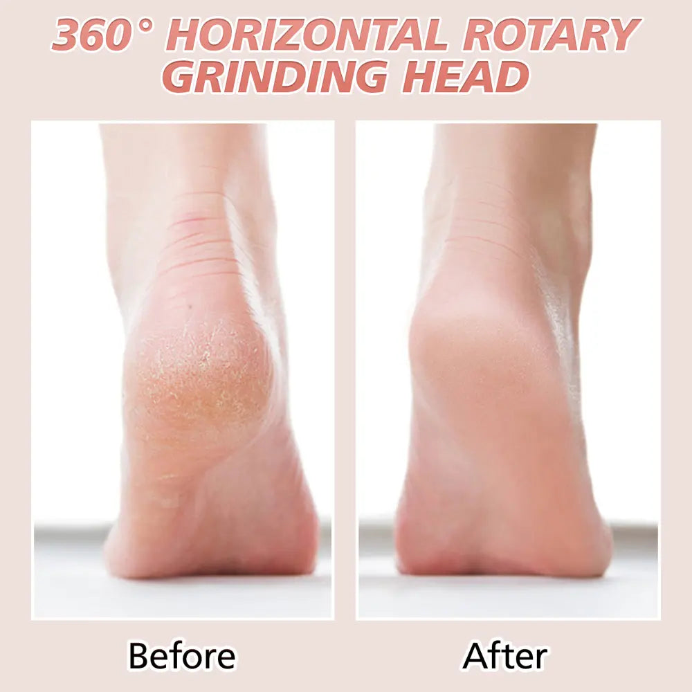 PRITECH Callus Remover | BCM-1253